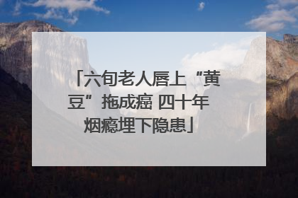 六旬老人唇上“黄豆”拖成癌 四十年烟瘾埋下隐患